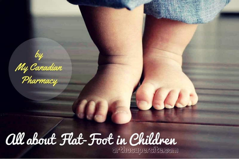 flat-feet in children