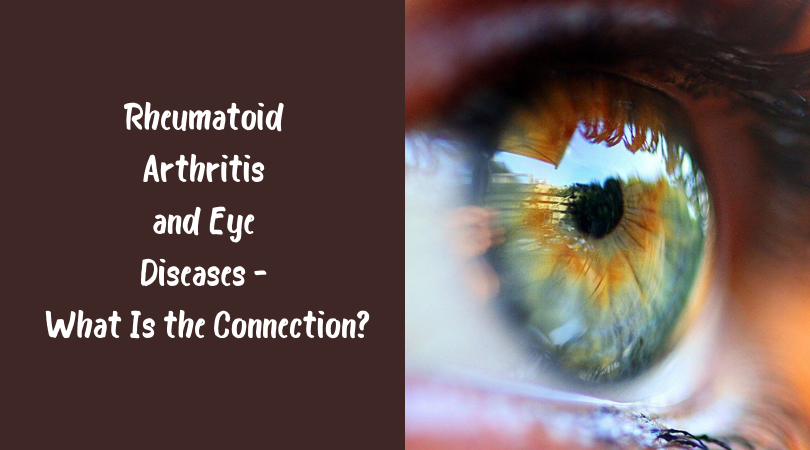 Rheumatoid Arthritis and Eye Diseases - What Is the Connection